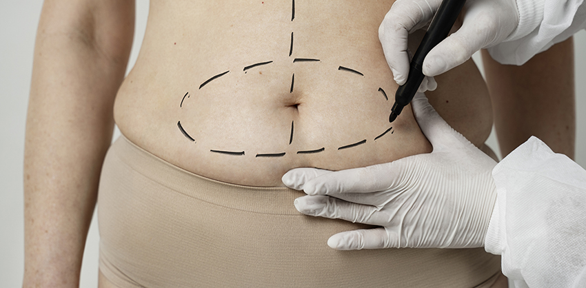 Chirurgie Esthétique et Plastique